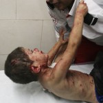 Palestinian medic tries to comfort a wounded boy at Shifa hospital in Gaza City, northern Gaza Strip,